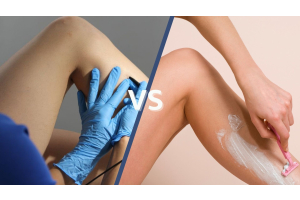electrolysis vs shaving