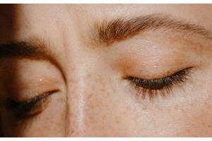 sunspot treatments NYC