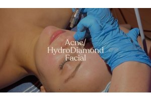 Acne/HydroDiamond Facial At Nios Spa NYC
