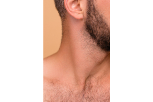 electrolysis for men