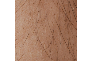 Understanding the hair growth cycle