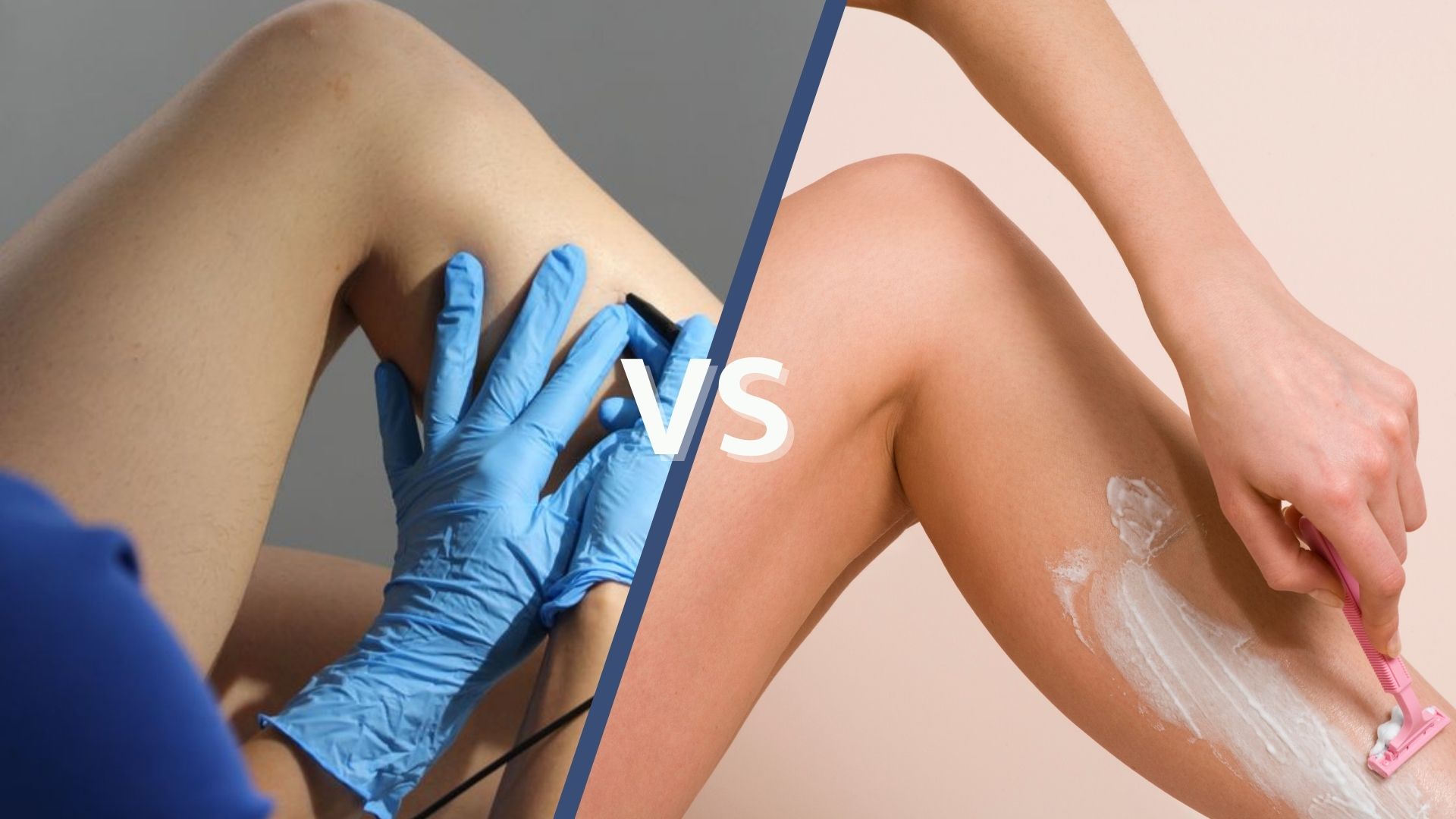 electrolysis vs shaving