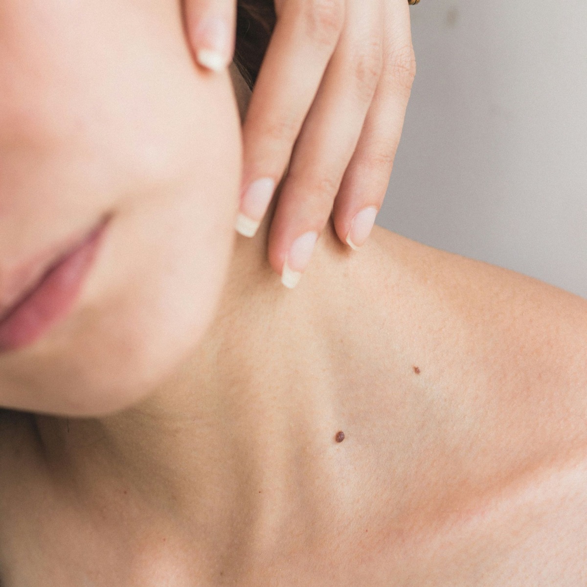 sideburns hair removal