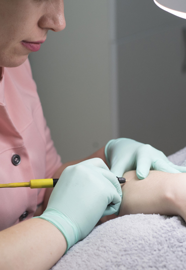 nios electrolysis