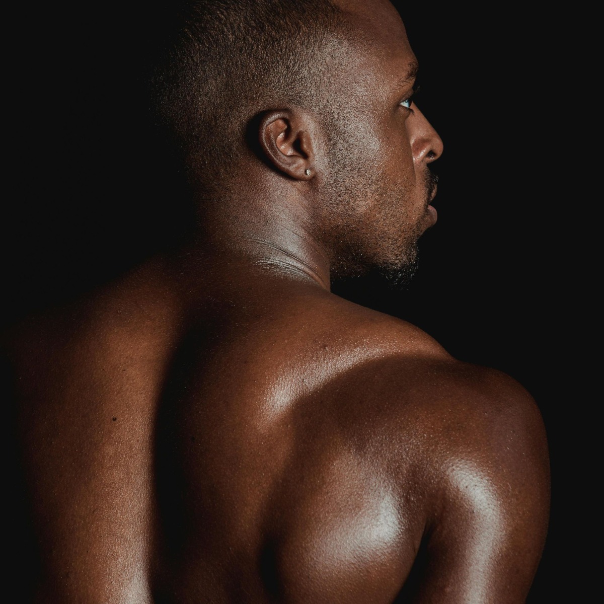 Professional back hair removal electrolysis treatment results for men in NYC