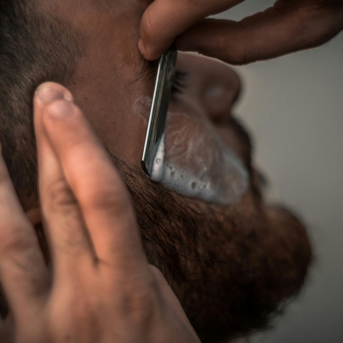 Permanent beard removal results NYC professional electrolysis treatment