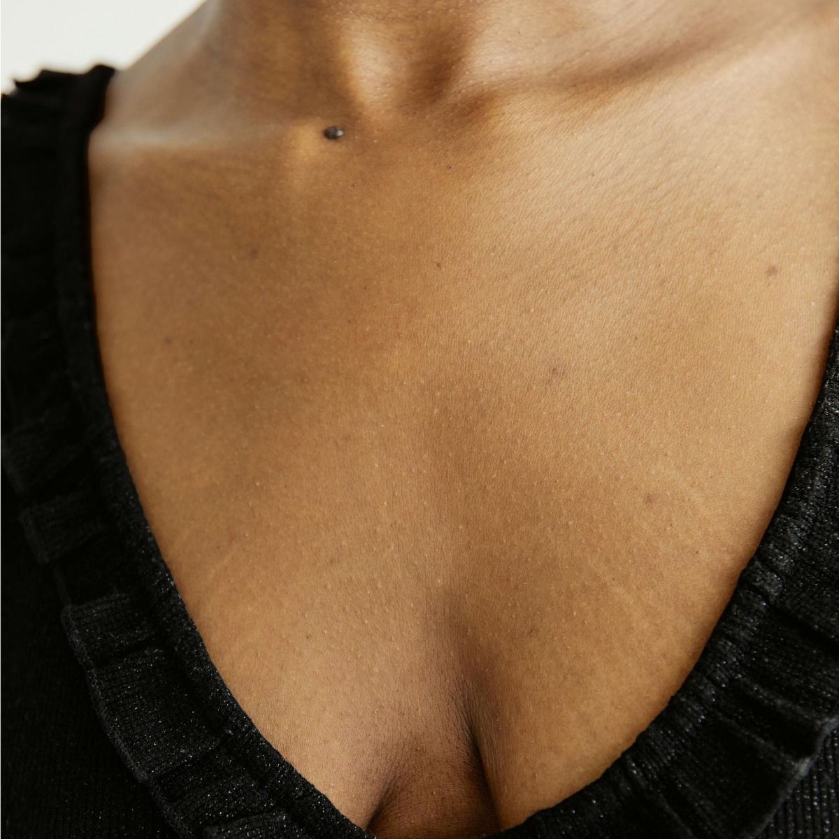 Permanent nipple hair removal with electrolysis in a welcoming NYC spa setting