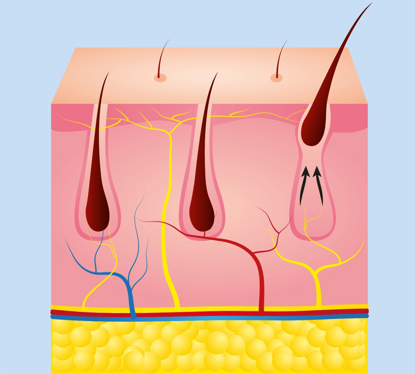 Electrolysis Permanent Hair Removal in NYC | How it Works, Methods &  Performance