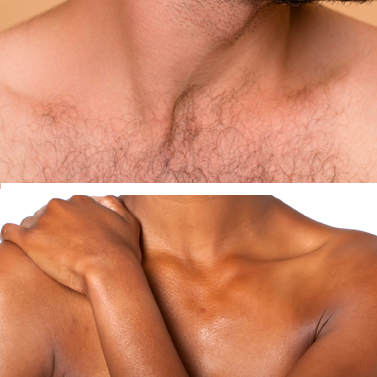 Do women find chest hair attractive? - Quora