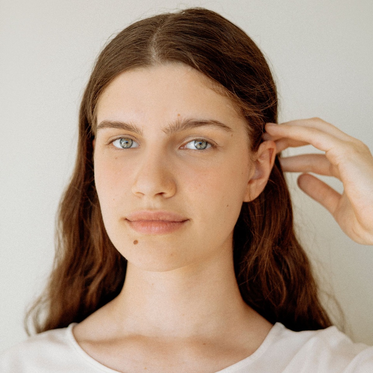face with mole after electrolysis hair removal
