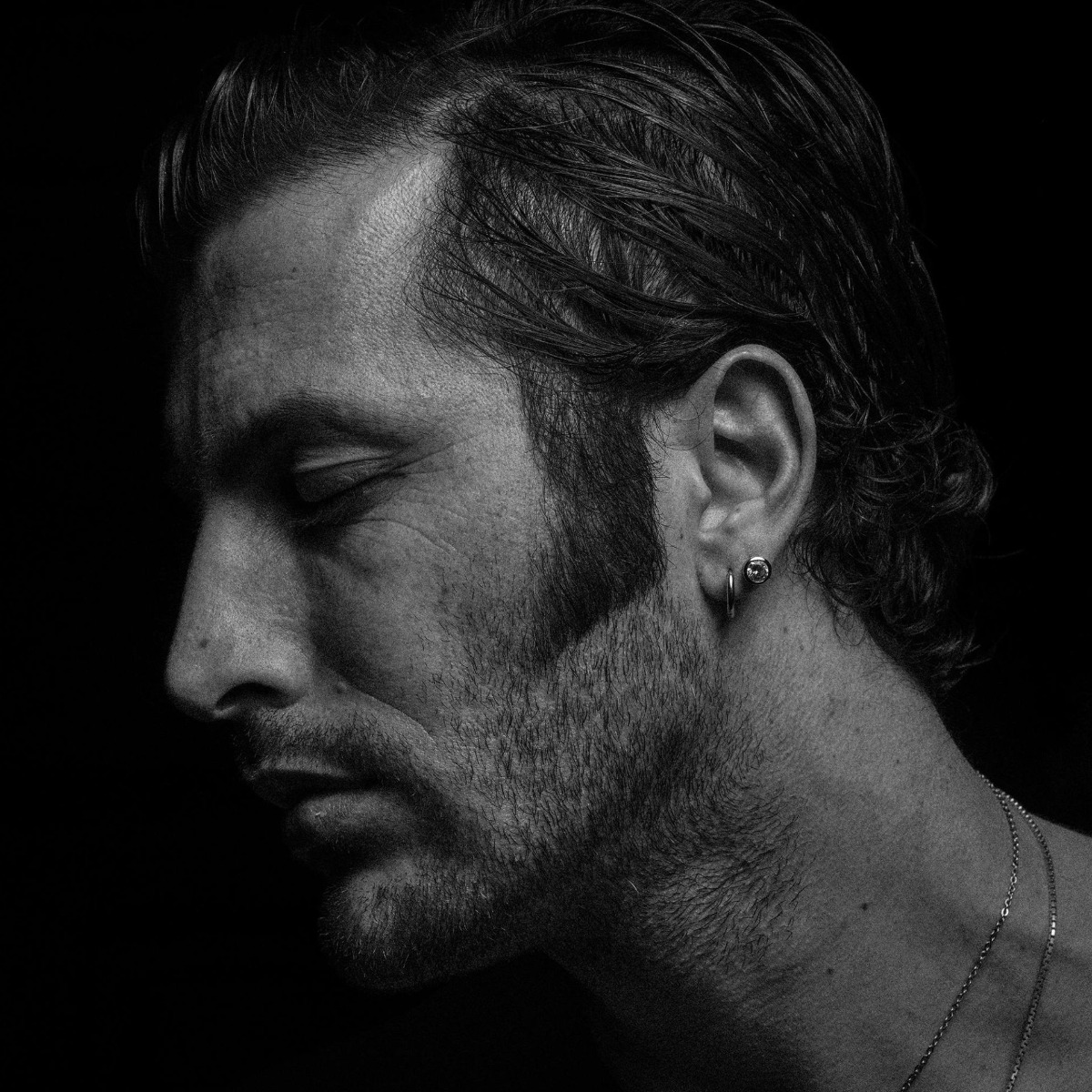 Sideburn Hair Removal NYC